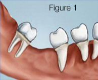 figure1